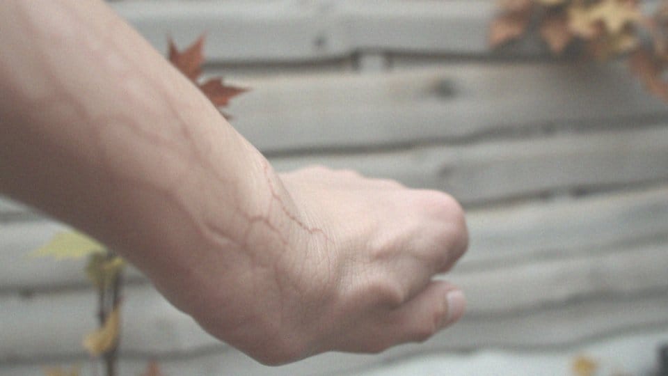 Wędrujący świąd skóry – przyczyny, objawy i diagnostyka